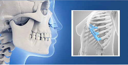Sửa mũi sụn sườn hỏng: Dấu hiệu, nguyên nhân và cách khắc phục 1 sửa mũi sụn sườn hỏng